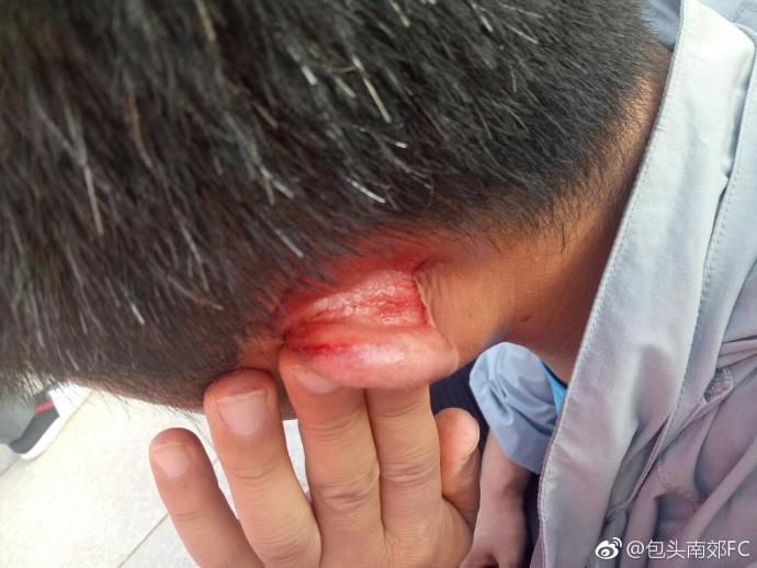 九游娱乐官方平台-包含宁夏山屿海队员奋力拼抢，主场取胜引无数掌声！的词条